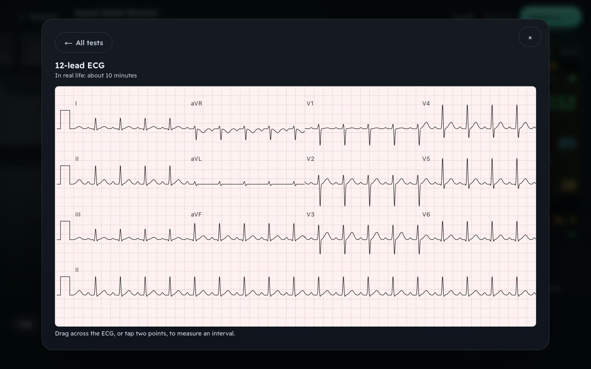 A 12-lead ECG ordered during the consultation.